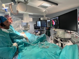 Quirónsalud Sagrado Corazón refuerza su Unidad de Arritmias con la ablación por campo pulsado, una innovadora técnica para tratar la fibrilación auricular