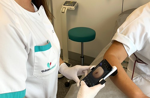 La detección precoz y la protección solar son los mejores escudos para salvar vidas frente al cáncer de piel